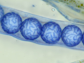 Lamprospora aberrans, spores stained with cotton-blue