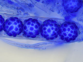 Lamprospora bulbiformis, spores stained with cotton-blue