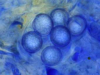 Lamprospora carbonicola, spores stained with cotton-blue
