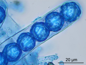 Lamprospora dicranellae, ascospores