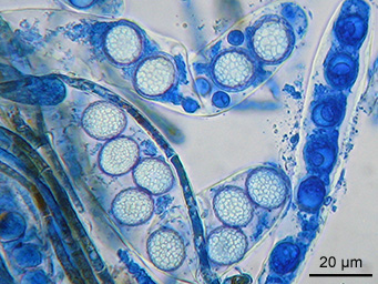 Lamprospora dictydiola, asci with ascospores