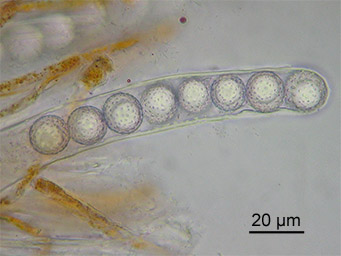 Lamprospora ecksteinii, ascus with ascospores