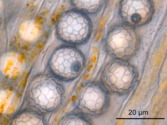 Lamprospora miniata, asci with ascospores