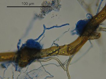 Lamprospora miniata var. parvispora, infectious hyphae on rhizoid
