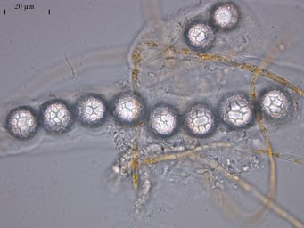 Lamprospora miniata var. ratisbonensis, asci with ascospores