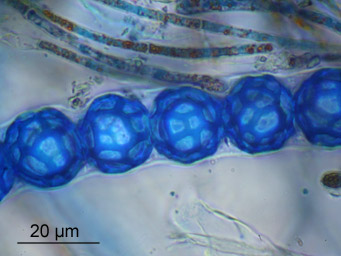 Lamprospora pseudoarvensis, spores stained with cotton-blue