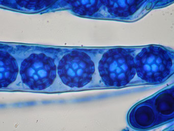 Lamprospora sylvatica, spores stained with cotton-blue