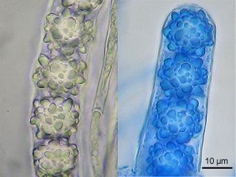 Lamprospora tuberculata, spores in water (left) and spores stained with lactophenol-cotton-blue (right)