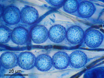Lamprospora verrucispora, spores stained with cotton-blue