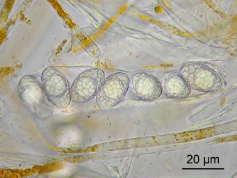Neottiella albocincta, ascus with ascospores