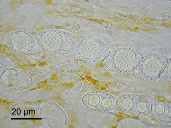 Neottiella rutilans, ascus with ascospores
