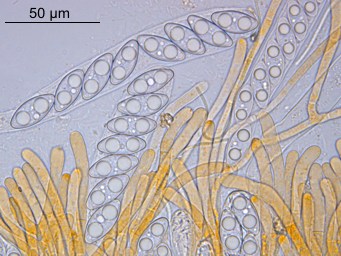 Octospora axillaris, asci with ascospores