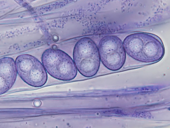 Octospora conidiophora