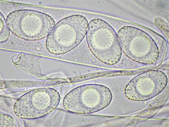 Octospora doebbeleri