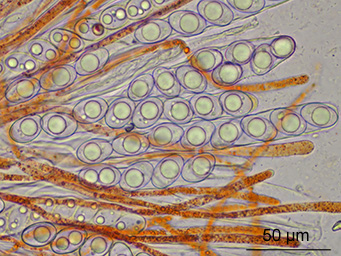 Octospora grimmiae, asci with ascospores