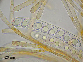Octospora gyalectoides, ascus with ascospores