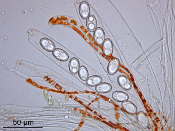 Octospora humosa, ascus with ascospores