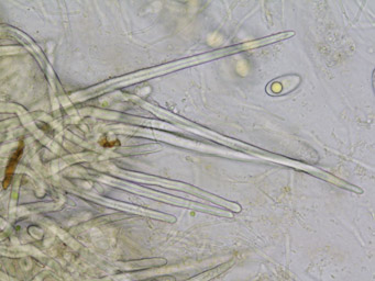 Octosporella jungermanniarum, hair-like hyphae from the outside of ascoma