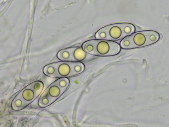 Octosporella jungermanniarum, spores