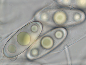 Octosporella jungermanniarum, ascospores