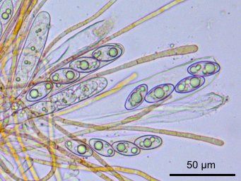 Octospora leucoloma var. tetraspora, asci with ascospores