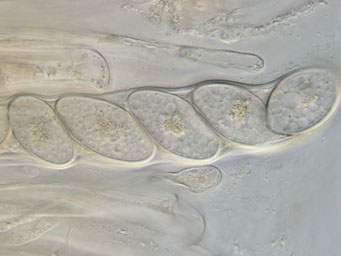 Octosporopsis nicolai