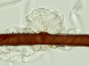 Octospora oscarii