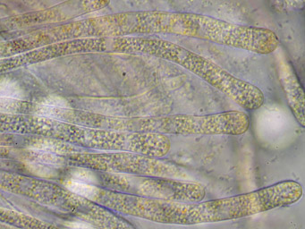 Octospora pannosa, paraphyses