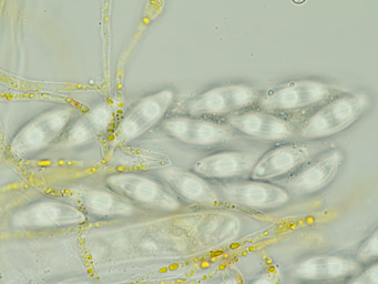 Octospora sulcatispora